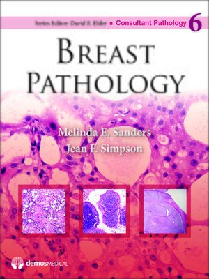 cover image of Breast Pathology